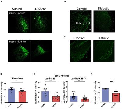 Locus coeruleus inhibition of vibrissal responses in the trigeminal subnucleus caudalis are reduced in a diabetic mouse model